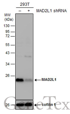 Non-transfected (–) and transfected (+) 293T whole cell extracts (30 μg) were separated by 12% SDS-PAGE, and the membrane was blotted with MAD2L1 antibody [N1C3] (GTX113489) diluted at 1:2000.