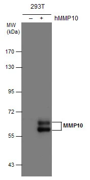 MMP10 antibody detects MMP10 protein by western blot analysis. Non-transfected (-) and MMP10-transfected (+) 293T whole cell extracts (30 μg) were separated by 7.5% SDS-PAGE, and the membrane was blotted with MMP10 antibody (GTX113496) diluted at 1:5000.