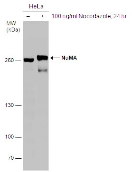 Untreated (–) and treated (+) HeLa whole cell extracts (30 μg) were separated by 5% SDS-PAGE, and the membrane was blotted with NuMA antibody [N1], N-term (GTX113510) diluted at 1:8000. The HRP-conjugated anti-rabbit IgG antibody (GTX213110-01) was used to detect the primary antibody.