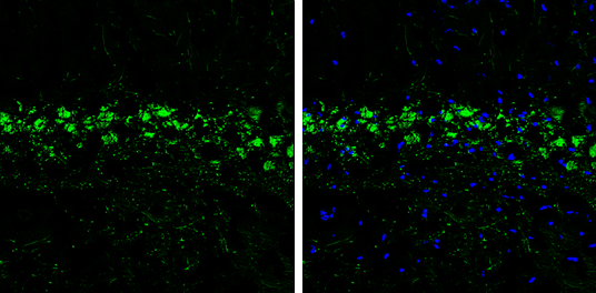 PDYN antibody [N1C2] detects PDYN protein by immunohistochemical analysis. Sample: Frozen-sectioned mouse hippocampus. Green: PDYN stained by PDYN antibody [N1C2] (GTX113515) diluted at 1:250. Blue: Fluoroshield with DAPI (GTX30920).