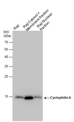 Cyclophilin A antibody detects Cyclophilin A protein by western blot analysis. Raji whole cell extracts and cytoplasma+membrane and nuclear extracts (30 μg) were separated by 12% SDS-PAGE, and the membrane was blotted with Cyclophilin A antibody (GTX113520) at a dilution of 1:1000. The HRP-conjugated anti-rabbit IgG antibody (GTX213110-01) was used to detect the primary antibody.