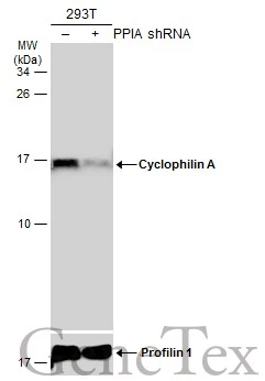 Non-transfected (–) and transfected (+) 293T whole cell extracts (30 μg) were separated by 15% SDS-PAGE, and the membrane was blotted with Cyclophilin A antibody [N1C3] (GTX113520) diluted at 1:1000. The HRP-conjugated anti-rabbit IgG antibody (GTX213110-01) was used to detect the primary antibody.