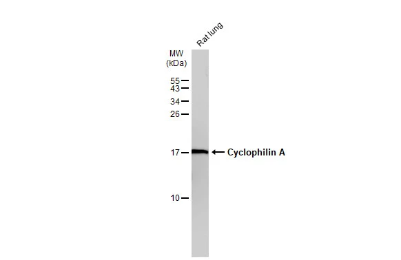 Rat tissue extract (50 μg) was separated by 15% SDS-PAGE, and the membrane was blotted with Cyclophilin A antibody [N1C3] (GTX113520) diluted at 1:1000. The HRP-conjugated anti-rabbit IgG antibody (GTX213110-01) was used to detect the primary antibody.