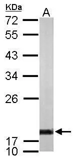 Sample (50 μg of whole cell lysate) A: mouse brain 12% SDS PAGE GTX113520 diluted at 1:1000 The HRP-conjugated anti-rabbit IgG antibody (GTX213110-01) was used to detect the primary antibody.
