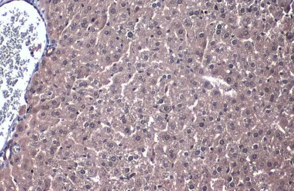 PP2A alpha antibody detects PP2A alpha protein at cytoplasm by immunohistochemical analysis. Sample: Paraffin-embedded mouse liver. PP2A alpha stained by PP2A alpha antibody (GTX113523) diluted at 1:1000. Antigen Retrieval: Citrate buffer, pH 6.0, 15 min