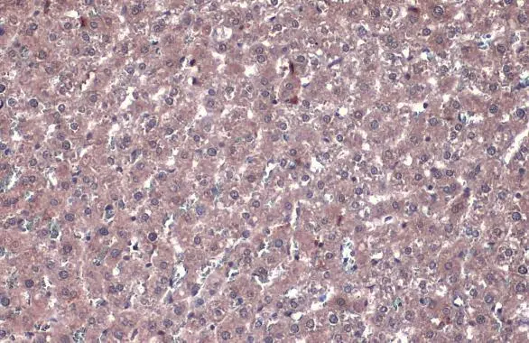 PP2A alpha antibody detects PP2A alpha protein at cytoplasm by immunohistochemical analysis. Sample: Paraffin-embedded rat liver. PP2A alpha stained by PP2A alpha antibody (GTX113523) diluted at 1:1000. Antigen Retrieval: Citrate buffer, pH 6.0, 15 min