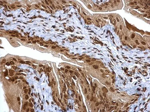 Proteasome 20S alpha 6 antibody detects Proteasome 20S alpha 6 protein at cytosol and nucleus on mouse urinary bladder by immunohistochemical analysis. Sample: Paraffin-embedded mouse urinary bladder. Proteasome 20S alpha 6 antibody (GTX113530) dilution: 1:500. 
 Antigen Retrieval: Trilogy? (EDTA based, pH 8.0) buffer, 15min