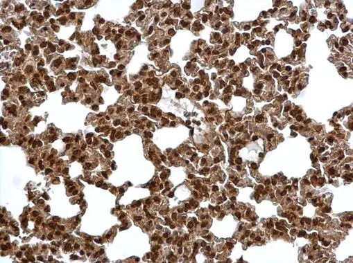 Proteasome 20S alpha 6 antibody detects Proteasome 20S alpha 6 protein at cytosol and nucleus on mouse lung by immunohistochemical analysis. Sample: Paraffin-embedded mouse lung. Proteasome 20S alpha 6 antibody (GTX113530) dilution: 1:500. 
 Antigen Retrieval: Trilogy? (EDTA based, pH 8.0) buffer, 15min