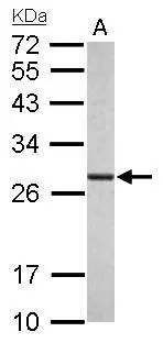 Proteasome 20S alpha 6 antibody detects PSMA6 protein by Western blot analysis. A. 50 μg rat liver lysate/extract 12 % SDS-PAGE Proteasome 20S alpha 6 antibody (GTX113530) dilution: 1:1000