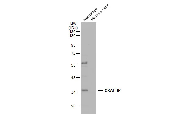 CRALBP antibody [N2C3]