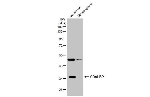 Various tissue extracts (50 μg) were separated by 10% SDS-PAGE, and the membrane was blotted with CRALBP antibody [N2C3] (GTX113541) diluted at 1:1000. The HRP-conjugated anti-rabbit IgG antibody (GTX213110-01) was used to detect the primary antibody.