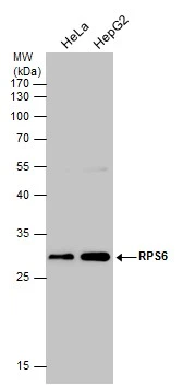 Various whole cell extracts (30 ug) were separated by 12% SDS-PAGE,and the membrane was blotted with RPS6 antibody (GTX113542) diluted at 1:500. The HRP-conjugated anti-rabbit IgG antibody (GTX213110-01) was used to detect the primary antibody.