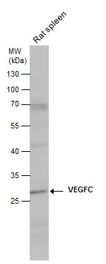 VEGFC antibody detects VEGFC protein by western blot analysis. Rat tissue extracts (50 μg) was separated by 10% SDS-PAGE, and the membrane was blotted with VEGFC antibody (GTX113574) diluted at 1:1000. The HRP-conjugated anti-rabbit IgG antibody (GTX213110-01) was used to detect the primary antibody.