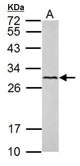 VEGFC antibody detects VEGFC protein by western blot analysis. A. 50 μg mouse lung lysate/extract 12% SDS-PAGE VEGFC antibody (GTX113574) dilution: 1:1000 The HRP-conjugated anti-rabbit IgG antibody (GTX213110-01) was used to detect the primary antibody.