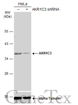 Non-transfected (–) and transfected (+) HeLa whole cell extracts (50 μg) were separated by 10% SDS-PAGE, and the membrane was blotted with AKR1C3 antibody [N1C1] (GTX113586) diluted at 1:5000. The HRP-conjugated anti-rabbit IgG antibody (GTX213110-01) was used to detect the primary antibody.