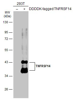 Non-transfected (–) and transfected (+) 293T whole cell extracts (30 μg) were separated by 10% SDS-PAGE, and the membrane was blotted with TNFRSF14 antibody [N2C3] (GTX113589) diluted at 1:5000. The HRP-conjugated anti-rabbit IgG antibody (GTX213110-01) was used to detect the primary antibody.