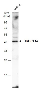 Whole cell extract (30 μg) was separated by 10% SDS-PAGE, and the membrane was blotted with TNFRSF14 antibody [N2C3] (GTX113589) diluted at 1:500. The HRP-conjugated anti-rabbit IgG antibody (GTX213110-01) was used to detect the primary antibody.