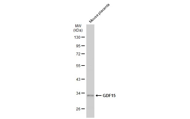 Mouse tissue extract (50 μg) was separated by 10% SDS-PAGE, and the membrane was blotted with GDF15 antibody [N1C3] (GTX113598) diluted at 1:1000. The HRP-conjugated anti-rabbit IgG antibody (GTX213110-01) was used to detect the primary antibody.