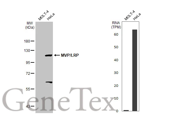Various whole cell extracts (30 μg) were separated by 7.5% SDS-PAGE, and the membrane was blotted with MVP/LRP antibody (GTX113601) diluted at 1:1000. The HRP-conjugated anti-rabbit IgG antibody (GTX213110-01) was used to detect the primary antibody. Corresponding RNA expression data for the same cell lines are based on Human Protein Atlas program. Various whole cell extracts (30 μg) were separated by 7.5% SDS-PAGE, and the membrane was blotted with MVP/LRP antibody (GTX113601) diluted at 1:1000. The HRP-conjugated anti-rabbit IgG antibody (GTX213110-01) was used to detect the primary antibody. Corresponding RNA expression data for the same cell lines are based on Human Protein Atlas program.