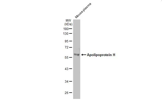 Mouse tissue extract (50 μg) was separated by 10% SDS-PAGE, and the membrane was blotted with Apolipoprotein H antibody [N1C2] (GTX113627) diluted at 1:1000. The HRP-conjugated anti-rabbit IgG antibody (GTX213110-01) was used to detect the primary antibody.