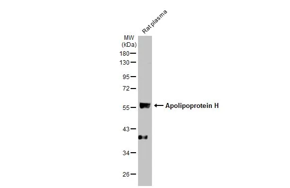 Rat tissue extract (50 μg) was separated by 10% SDS-PAGE, and the membrane was blotted with Apolipoprotein H antibody [N1C2] (GTX113627) diluted at 1:1000. The HRP-conjugated anti-rabbit IgG antibody (GTX213110-01) was used to detect the primary antibody.