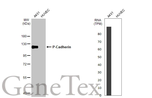 Various whole cell extracts (30 μg) were separated by 7.5% SDS-PAGE, and the membrane was blotted with P-Cadherin antibody (GTX113648) diluted at 1:5000. The HRP-conjugated anti-rabbit IgG antibody (GTX213110-01) was used to detect the primary antibody.Corresponding RNA expression data for the same cell lines are based on Human Protein Atlas program.
