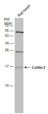 Rat tissue extract (50 μg) was separated by 15% SDS-PAGE, and the membrane was blotted with Cofilin 2 antibody (GTX113650) diluted at 1:500.