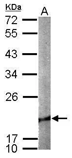 Sample (50 ug of whole cell lysate) A: mouse brain 12% SDS PAGE GTX113650 diluted at 1:1000 Sample (50 ug of whole cell lysate) A: mouse brain 12% SDS PAGE GTX113650 diluted at 1:1000