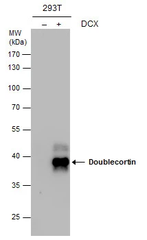 Doublecortin antibody detects Doublecortin protein by western blot analysis. Non-transfected (-) and Doublecortin-transfected (+, ) 293T whole cell extracts (30 μg) were separated by 10% SDS-PAGE, and the membrane was blotted with Doublecortin antibody (GTX113671) at a dilution of 1:10000.