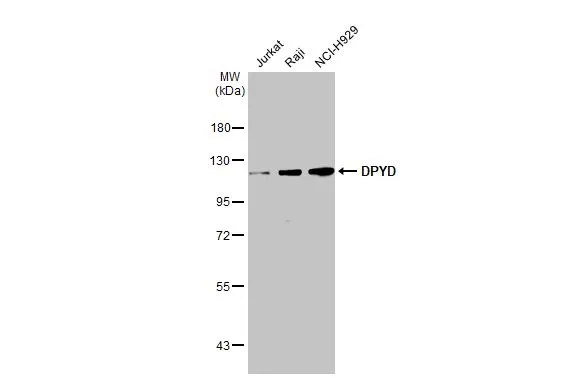Various whole cell extracts (30 μg) were separated by 7.5% SDS-PAGE, and the membrane was blotted with DPYD antibody [N1N2], N-term (GTX113672) diluted at 1:1000. The HRP-conjugated anti-rabbit IgG antibody (GTX213110-01) was used to detect the primary antibody.