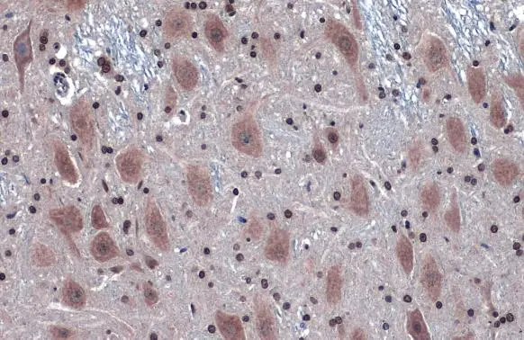 IRE1 alpha antibody [N1N2], N-term detects IRE1 alpha protein at cytoplasm by immunohistochemical analysis. Sample: Paraffin-embedded rat brain. IRE1 alpha stained by IRE1 alpha antibody [N1N2], N-term (GTX113682) diluted at 1:500. Antigen Retrieval: Citrate buffer, pH 6.0, 15 min