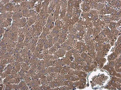 Factor IX antibody [N3C3] detects Factor IX protein at cytoplasm in rat liver by immunohistochemical analysis. Sample: Paraffin-embedded rat liver. Factor IX antibody [N3C3] (GTX113689) diluted at 1:500. 
 Antigen Retrieval: Citrate buffer, pH 6.0, 15 min