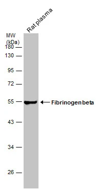 Rat tissue extract (30 μg) was separated by 10% SDS-PAGE, and the membrane was blotted with Fibrinogen beta antibody [C1C3] (GTX113694) diluted at 1:50000. The HRP-conjugated anti-rabbit IgG antibody (GTX213110-01) was used to detect the primary antibody.