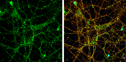 NMDAR2A antibody [C1C2], Internal detects NMDAR2A protein by immunofluorescent analysis. Sample: DIV14 rat E18 primary cortical neurons were fixed in 4% paraformaldehyde at RT for 15 min. Green: NMDAR2A protein stained by NMDAR2A antibody [C1C2], Internal (GTX113717) diluted at 1:500. Red: beta Tubulin 3/ Tuj1, stained by beta Tubulin 3/ Tuj1 antibody [GT1338] (GTX631831) diluted at 1:500. Blue: Fluoroshield with DAPI (GTX30920).