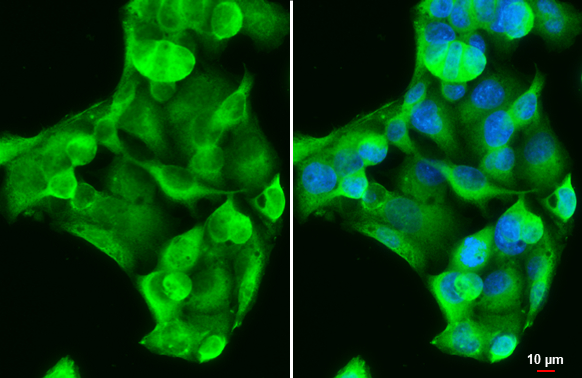 GSTA1 antibody detects GSTA1 protein at cytoplasm by immunofluorescent analysis. Sample: HepG2 cells were fixed in 4% paraformaldehyde at RT for 15 min. Green: GSTA1 stained by GSTA1 antibody (GTX113722) diluted at 1:500. Blue: Fluoroshield with DAPI (GTX30920). Scale bar= 10 μm. GSTA1 antibody detects GSTA1 protein at cytoplasm by immunofluorescent analysis. Sample: HepG2 cells were fixed in 4% paraformaldehyde at RT for 15 min. Green: GSTA1 stained by GSTA1 antibody (GTX113722) diluted at 1:500. Blue: Fluoroshield with DAPI (GTX30920). Scale bar= 10 μm.