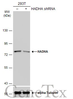 Non-transfected (–) and transfected (+) 293T whole cell extracts (30 μg) were separated by 7.5% SDS-PAGE, and the membrane was blotted with HADHA antibody [N2C1], Internal (GTX113727) diluted at 1:1000. The HRP-conjugated anti-rabbit IgG antibody (GTX213110-01) was used to detect the primary antibody.