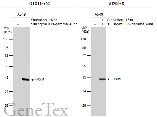 Untreated (–) and treated (+) A549 whole cell extracts (30 μg) were separated by 10% SDS-PAGE, and the membranes were blotted with IDO1 antibody (GTX113753) diluted at 1:3000 and competitor's antibody (CST#12006S) diluted by 1:500. The HRP-conjugated anti-rabbit IgG antibody (GTX213110-01) was used to detect the primary antibody.