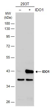 Non-transfected (–) and transfected (+) 293T whole cell extracts (30 μg) were separated by 10% SDS-PAGE, and the membrane was blotted with IDO1 antibody (GTX113753) diluted at 1:1000. The HRP-conjugated anti-rabbit IgG antibody (GTX213110-01) was used to detect the primary antibody.