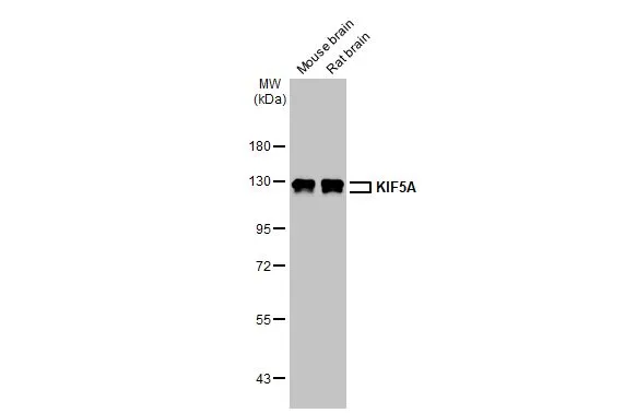 Various tissue extracts (50 μg) were separated by 7.5% SDS-PAGE, and the membrane was blotted with KIF5A antibody [N3C2], Internal (GTX113761) diluted at 1:1000. The HRP-conjugated anti-rabbit IgG antibody (GTX213110-01) was used to detect the primary antibody, and the signal was developed with Trident ECL plus-Enhanced.