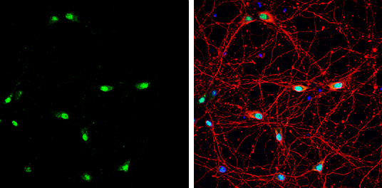 Muscleblind-like 1 antibody [N1C2] detects Muscleblind-like 1 protein by immunofluorescent analysis. Sample: DIV9 rat E18 primary hippocampal neuron cells were fixed in 4% paraformaldehyde at RT for 15 min. Green: Muscleblind-like 1 stained by Muscleblind-like 1 antibody [N1C2] (GTX113773) diluted at 1:500. Red: beta Tubulin 3/ Tuj1, stained by beta Tubulin 3/ Tuj1 antibody [GT11710] (GTX631836) diluted at 1:500. Blue: Fluoroshield with DAPI (GTX30920).