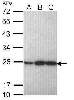 Sample (30 ug of whole cell lysate) A: H1299 B: Hela C: Hep G2 (GTX27900) 12% SDS PAGE GTX113793 diluted at 1:1000 