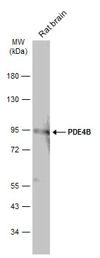 Rat tissue extract (50 μg) was separated by 7.5% SDS-PAGE, and the membrane was blotted with PDE4B antibody [C2C3], C-term (GTX113798) diluted at 1:500. The HRP-conjugated anti-rabbit IgG antibody (GTX213110-01) was used to detect the primary antibody.