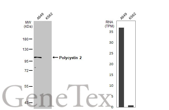 Various whole cell extracts (30 μg) were separated by 7.5% SDS-PAGE, and the membrane was blotted with Polycystin 2 antibody (GTX113802) diluted at 1:500. The HRP-conjugated anti-rabbit IgG antibody (GTX213110-01) was used to detect the primary antibody, and the signal was developed with Trident ECL plus-Enhanced. Corresponding RNA expression data for the same cell lines are based on Human Protein Atlas program.