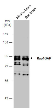 Various tissue extracts (50 μg) were separated by 7.5% SDS-PAGE, and the membrane was blotted with Rap1GAP antibody [N2C2], Internal (GTX113821) diluted at 1:1000. The HRP-conjugated anti-rabbit IgG antibody (GTX213110-01) was used to detect the primary antibody, and the signal was developed with Trident ECL plus-Enhanced.