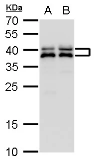SET antibody detects SET protein by Western blot analysis.