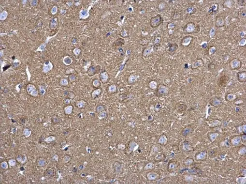 SNAP25 antibody detects SNAP25 protein expression by immunohistochemical analysis.