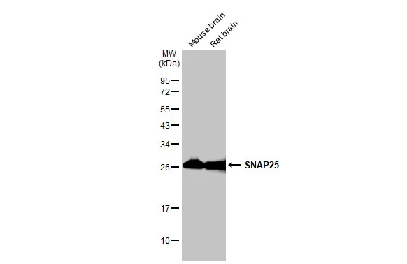 Various tissue extracts (50 μg) were separated by 12% SDS-PAGE, and the membrane was blotted with SNAP25 antibody (GTX113839) diluted at 1:1000. The HRP-conjugated anti-rabbit IgG antibody (GTX213110-01) was used to detect the primary antibody.