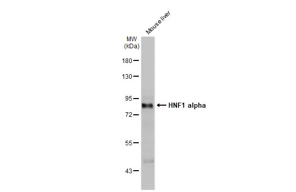 Mouse tissue extract (50 μg) was separated by 7.5% SDS-PAGE, and the membrane was blotted with HNF1 alpha antibody [N1N3] (GTX113850) diluted at 1:2000. The HRP-conjugated anti-rabbit IgG antibody (GTX213110-01) was used to detect the primary antibody.
