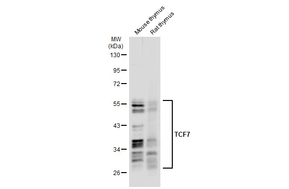 Various tissue extracts (50 μg) were separated by 10% SDS-PAGE, and the membrane was blotted with TCF7 antibody (GTX113851) diluted at 1:500. The HRP-conjugated anti-rabbit IgG antibody (GTX213110-01) was used to detect the primary antibody.