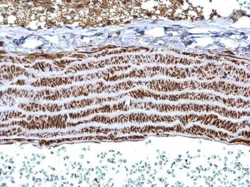 Tropomyosin 1 antibody detects Tropomyosin 1 protein at cytosol on mouse vein by immunohistochemical analysis. Sample: Paraffin-embedded mouse vein. Tropomyosin 1 antibody (GTX113857) dilution: 1:500. 
 Antigen Retrieval: Trilogy? (EDTA based, pH 8.0) buffer, 15min
